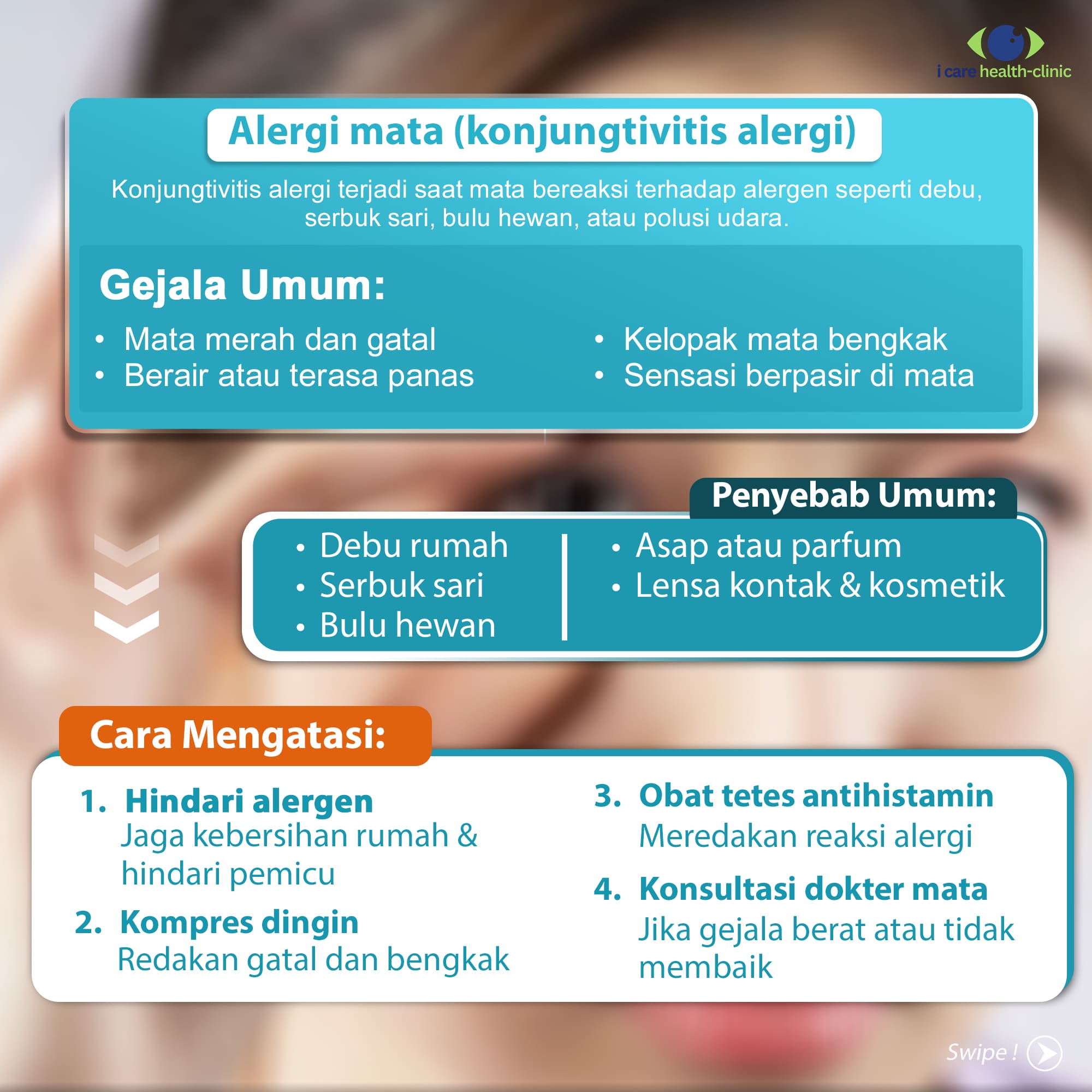 Alergi Pada Mata