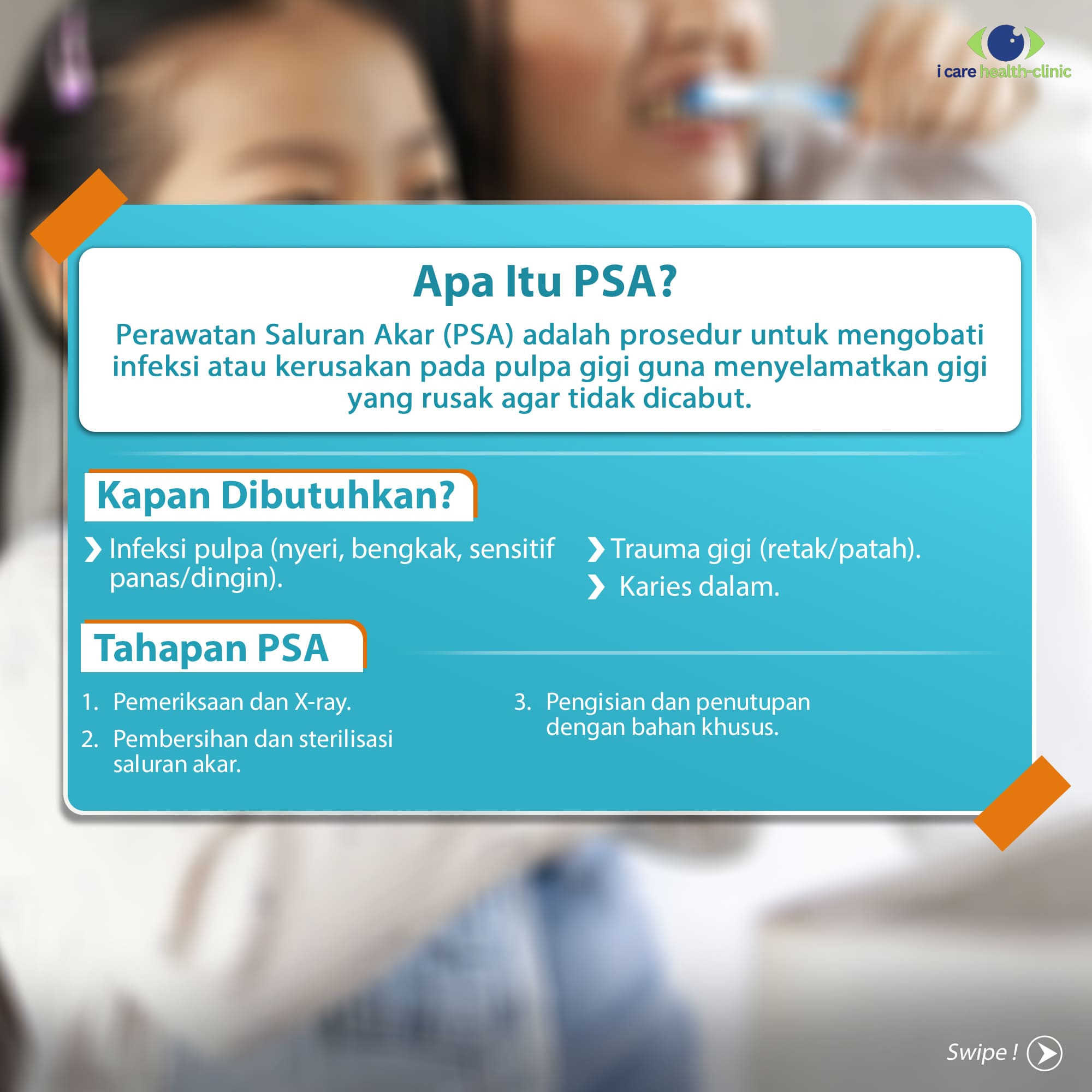 Perawatan Saluran Akar