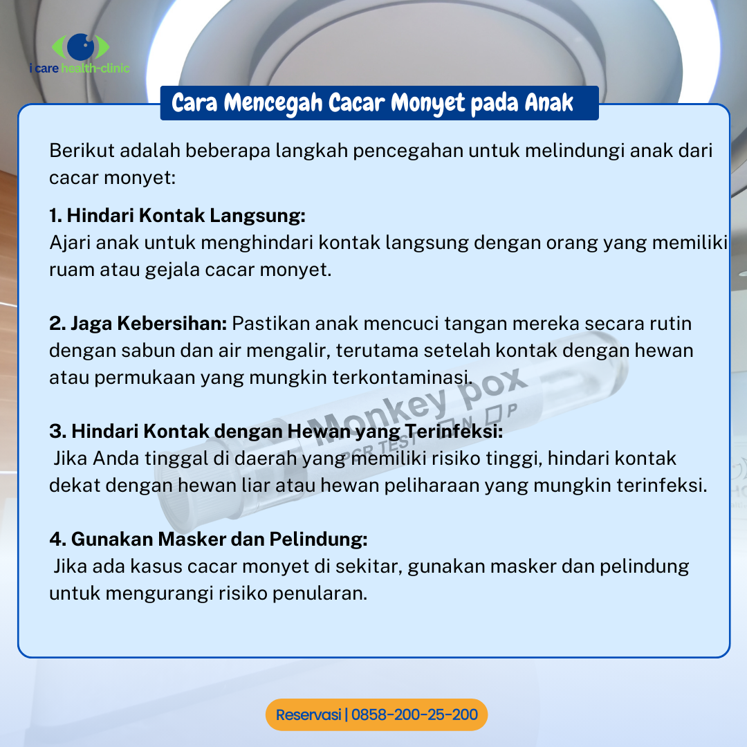 Monkey Pox pada anak